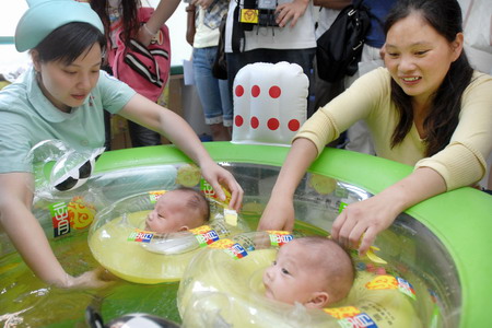 Conjoined twins separated and healthy