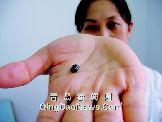 衛(wèi)生部發(fā)布“蜱的特點(diǎn)及預(yù)防控制知識(shí)”