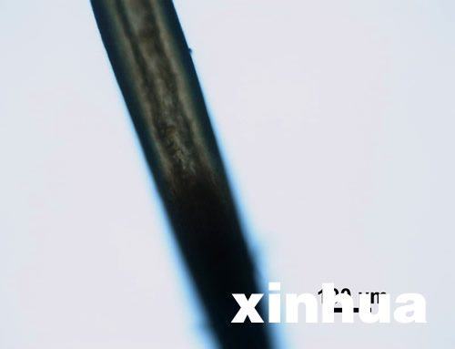 神農(nóng)架首次公布不明動(dòng)物毛發(fā)顯微照