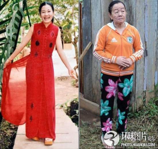 難以置信的罕見怪病:忘記呼吸 靜電過敏 聽鬧鐘響心臟停跳