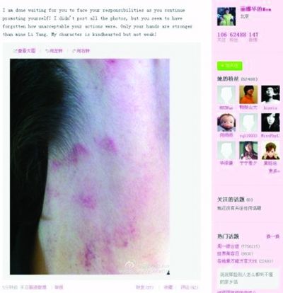 李陽再次家暴！妻子曝光照片