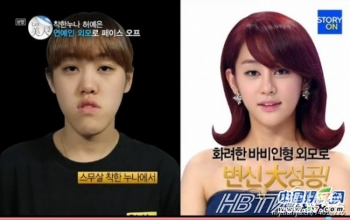 丑女變靚妹！韓國整容節目爆紅