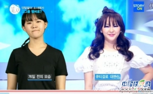 丑女變靚妹！韓國整容節(jié)目爆紅