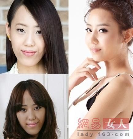 丑女變靚妹！韓國整容節目爆紅