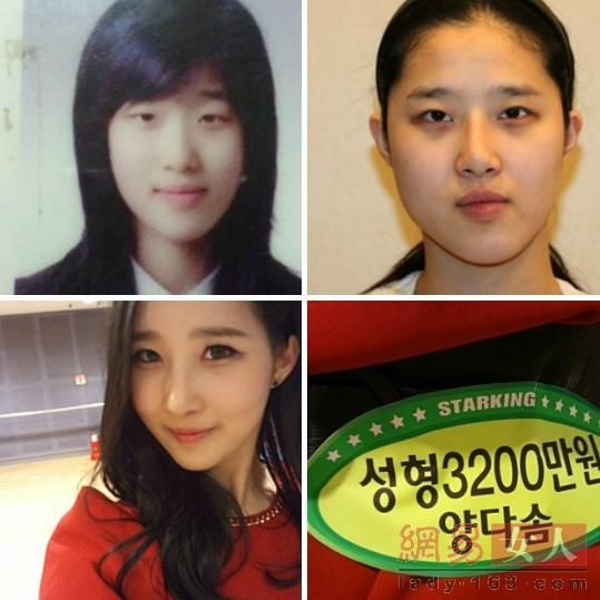 丑女變靚妹！韓國整容節(jié)目爆紅