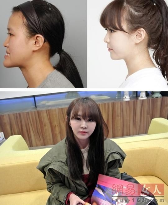 丑女變靚妹！韓國整容節目爆紅