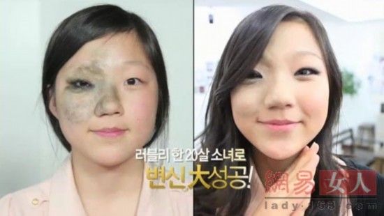 丑女變靚妹！韓國整容節(jié)目爆紅