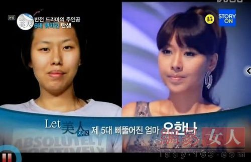 丑女變靚妹！韓國整容節(jié)目爆紅