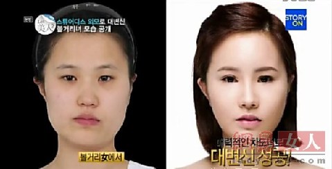 丑女變靚妹！韓國整容節目爆紅