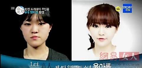 丑女變靚妹！韓國整容節目爆紅