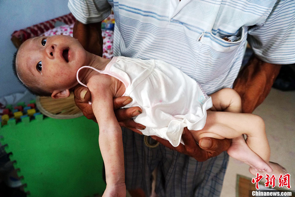 河南“饑餓娃娃”身體恢復良好 未來去向不定