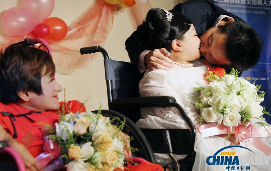 高清：“瓷娃娃”新人的特殊婚禮