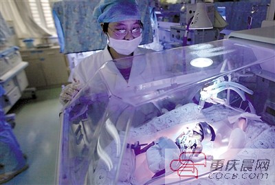 23周！重慶第一早產兒“筷子寶寶”正在頑強存活著