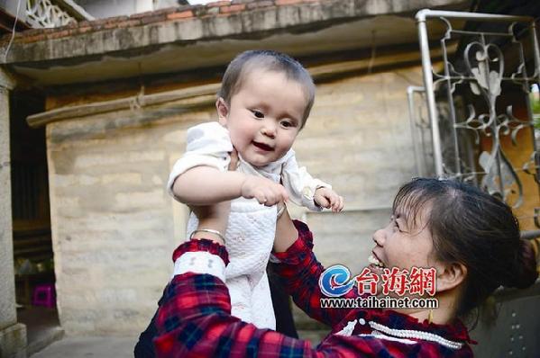 “奇跡寶寶”趙平安一周歲 后續可能還要做手術