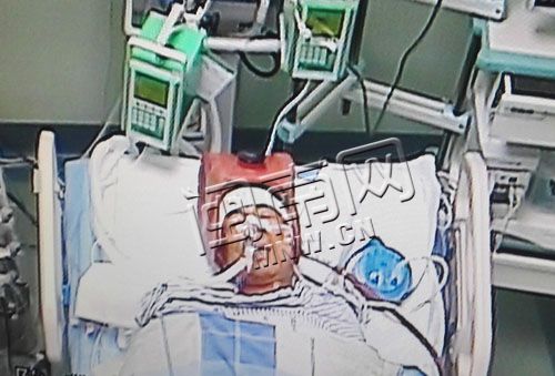 泉州60歲護(hù)林員山上撲火倒下 重癥室里昏迷不醒