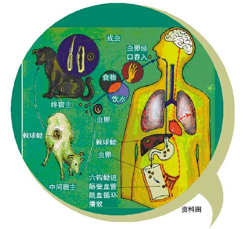 少女長(zhǎng)期與寵物睡覺(jué) 遭“寵物蟲(chóng)”噬骨導(dǎo)致癱瘓