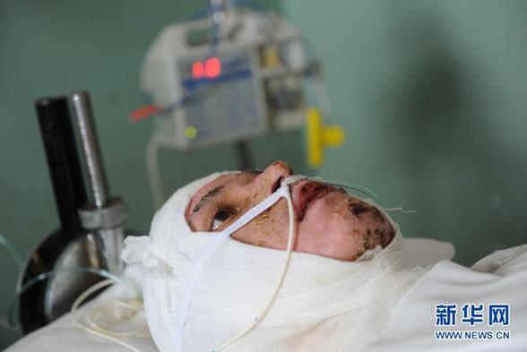 冒死救人的英雄羅杰終于醒了