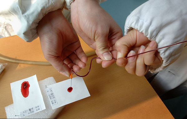 婚姻脆弱催熱親子鑒定 滴血認親一再上演