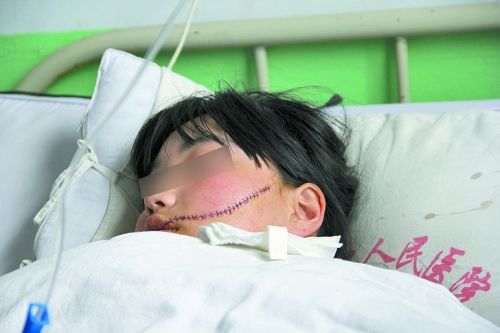 女中學生被同學用刀毀容 傷口長達13厘米(圖)