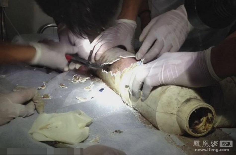 浙江廁所男嬰生母找到 系廁所產子滑入下水道