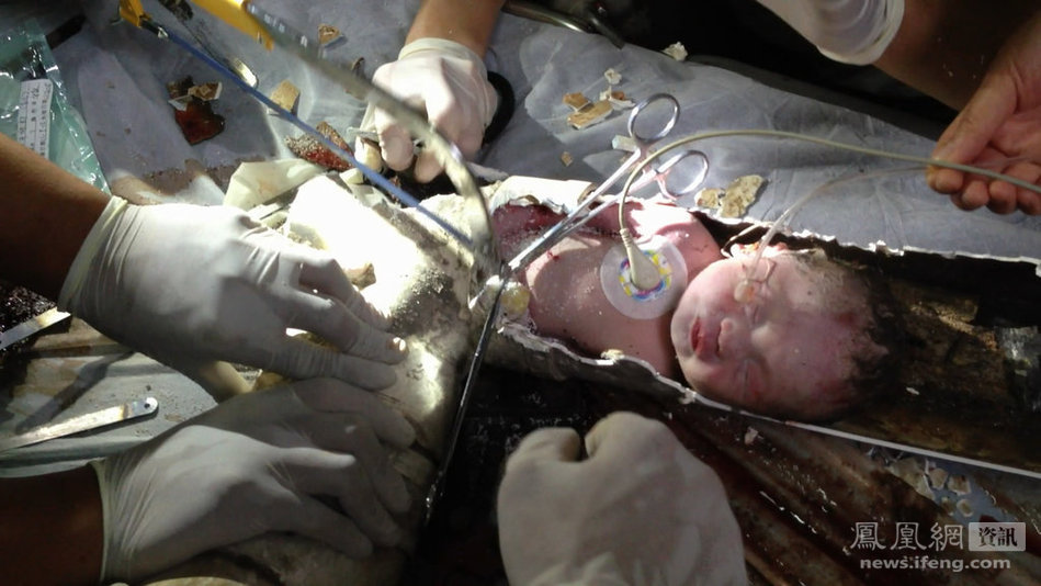 浙江廁所男嬰生母找到 系廁所產子滑入下水道