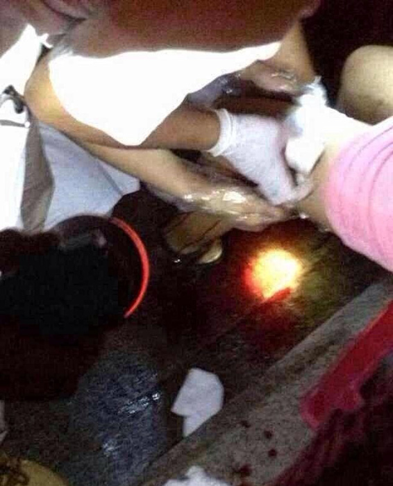 福建發生多起路人遭割肉事件 嫌疑人已被抓獲