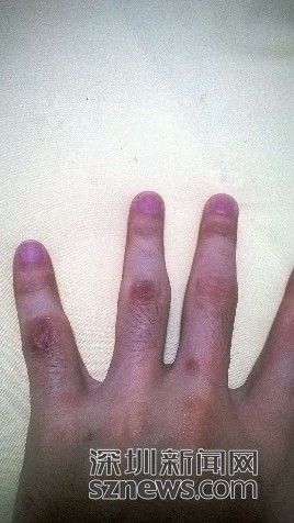 男子街頭遭兩名便衣警察毆打后被告知抓錯人