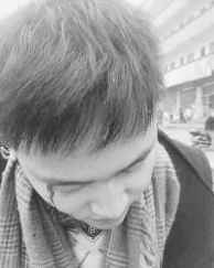 環保志愿者調查企業排污遭打 企業稱曾被人敲詐