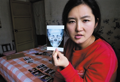 山西女孩赴韓國整容 12項手術(shù)無一項成功