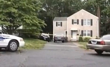 手臂被鍋爐卡住3天 美國男子自行截肢求生