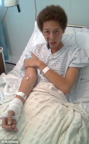 十字弓箭離奇自動發(fā)射 英17歲男孩面部受傷險些沒命