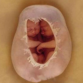 環球超可愛寶寶寫真