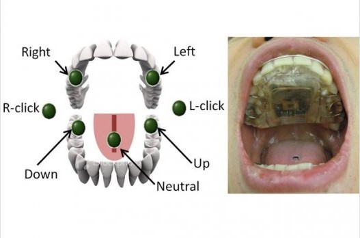 殘疾人可用舌頭操控輪椅！美研發易于操作驅動系統