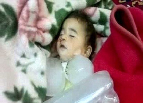 敘利亞哈馬省慘案幸存者回憶可怕細節(jié) 聯(lián)合國監(jiān)督團遭襲未能進入現(xiàn)場勘察