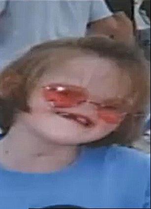 美女孩生來無鼻無眼 手術將用頭蓋骨為其重塑面容