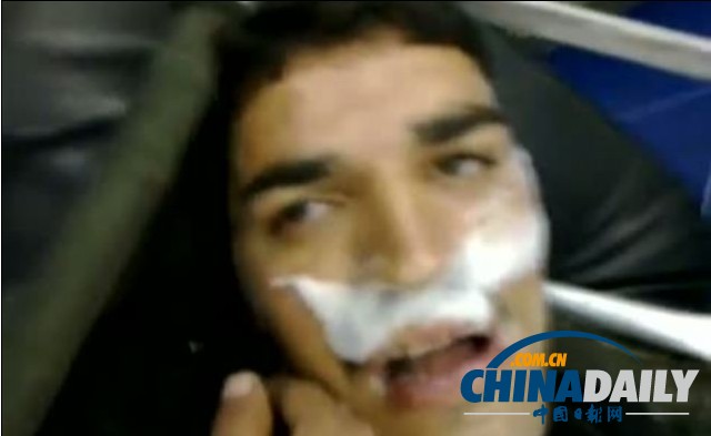 動(dòng)物尸體遍地照片被翻出 生化武器疑云籠罩?jǐn)⒗麃? width=