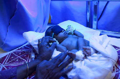 柬埔寨新生嬰兒的死亡