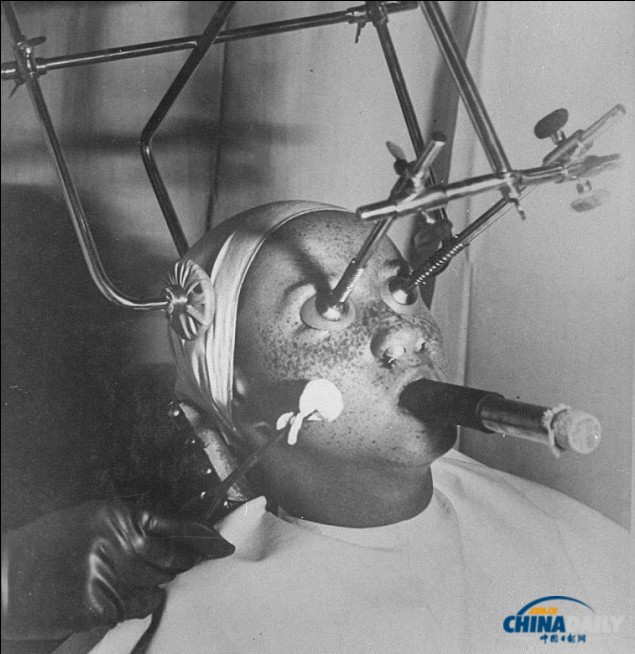 加熱美膚帽、冰凍祛斑機(jī) 圖說上世紀(jì)“恐怖”美容法