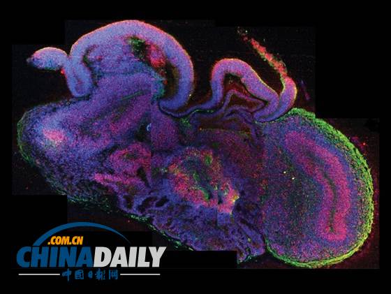 科學(xué)家利用干細(xì)胞培育人腦 達(dá)9周胎兒水平