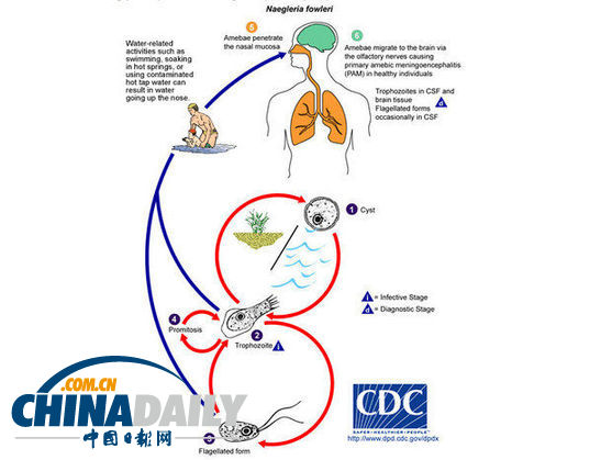 美國路易斯安那州飲用水中檢測出罕見“食腦蟲”