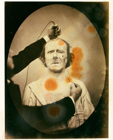 揭秘達(dá)爾文最后實(shí)驗(yàn):探索人類情緒表情扭曲