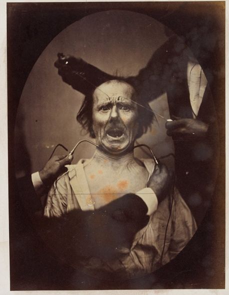 揭秘達爾文最后實驗:探索人類情緒表情扭曲