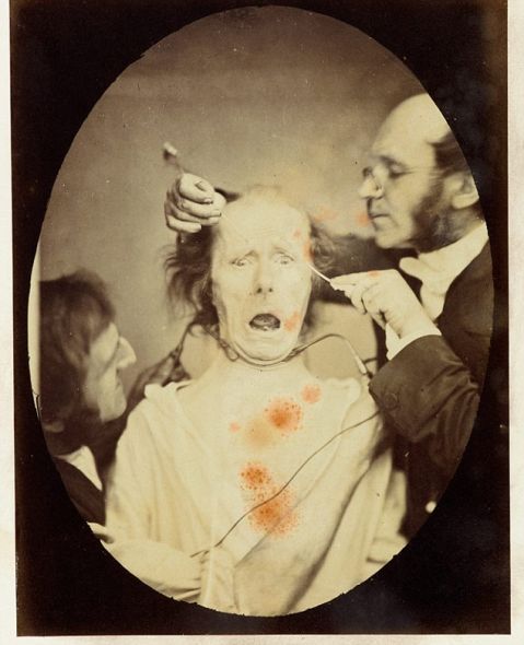 揭秘達爾文最后實驗:探索人類情緒表情扭曲