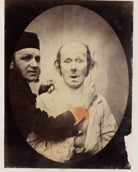 揭秘達爾文最后實驗:探索人類情緒表情扭曲