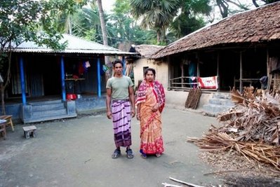 Formerly conjoined twins leave intensive care